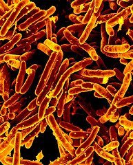 tuberculosis photo