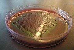 e coli photo