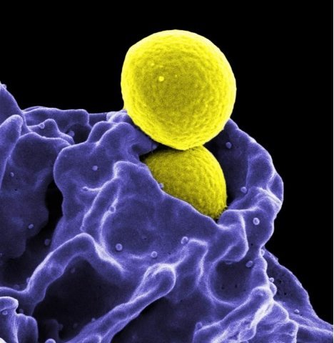 金黄色葡萄球菌